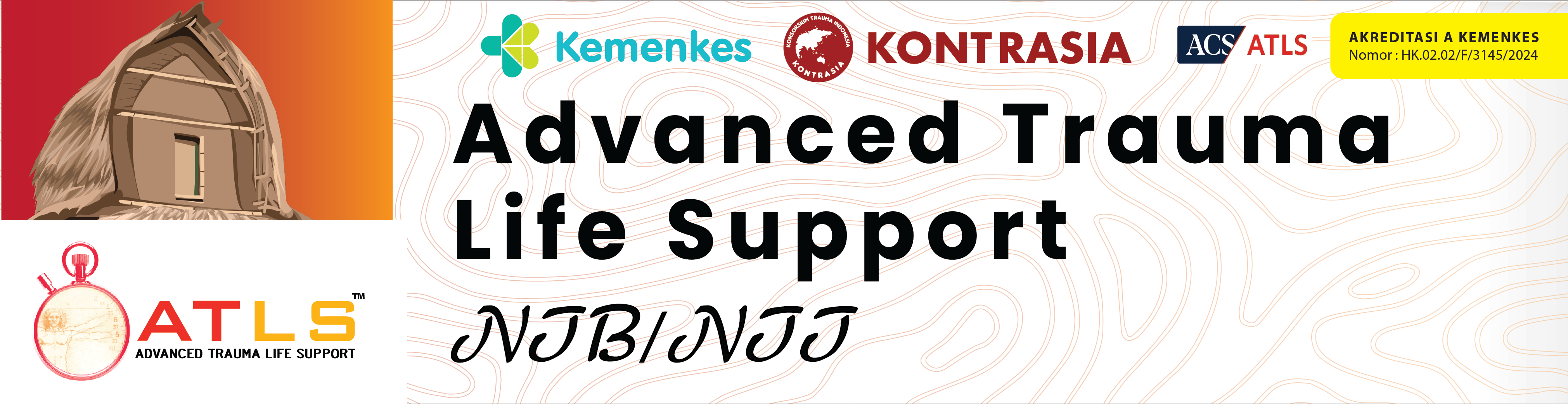 NTB/NTT